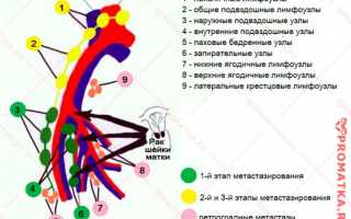 2 стадия онкологии матки и шейки матки: признаки, лечение, профилактика