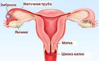 Покажет ли УЗИ внематочную беременность и как она выглядит: сроки определения и расшифровка