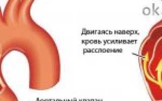Полная характеристика расслоения аорты: причины, диагностика, лечение