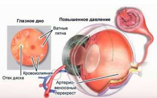 Глазное давление – капли для глаз самые безопасные без побочных эффектов